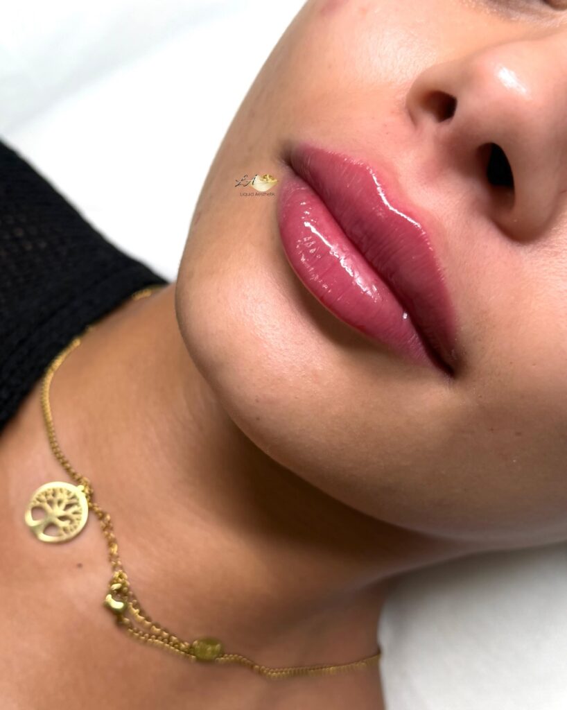 Πώς να κρατήσεις τα χείλη σου ενυδατωμένα στο κρύο