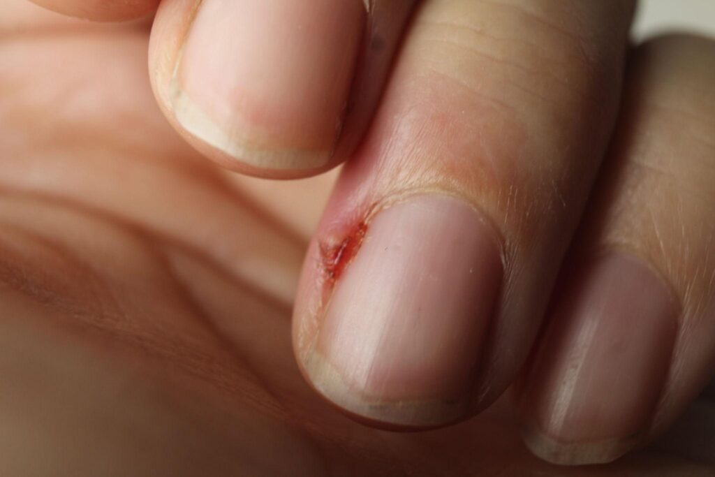 Τα 9 καθημερινά λάθη που «σπάνε» τα νύχια (και τι να κάνεις αντί για αυτά)