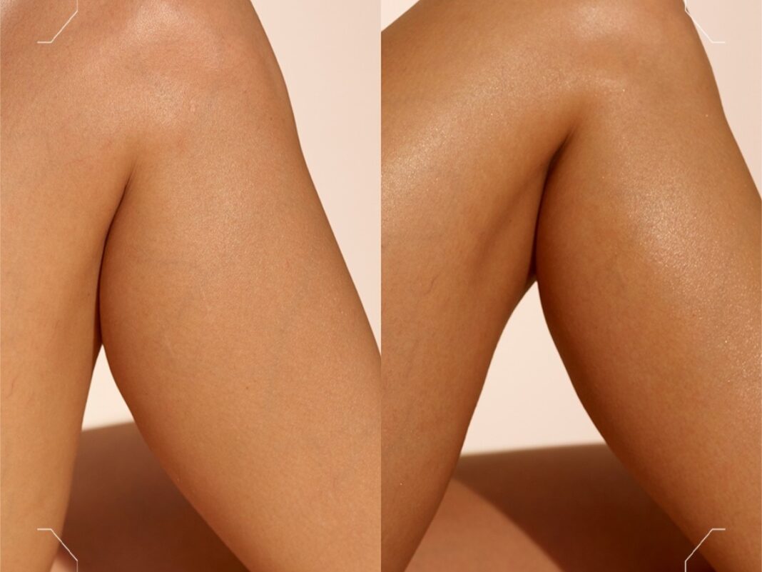 Self-tan στο σπίτι: ο πιο εύκολος τρόπος για φυσικό μαύρισμα χωρίς λεκέδες Self-tan στο σπίτι: ο πιο εύκολος τρόπος για φυσικό μαύρισμα χωρίς λεκέδες