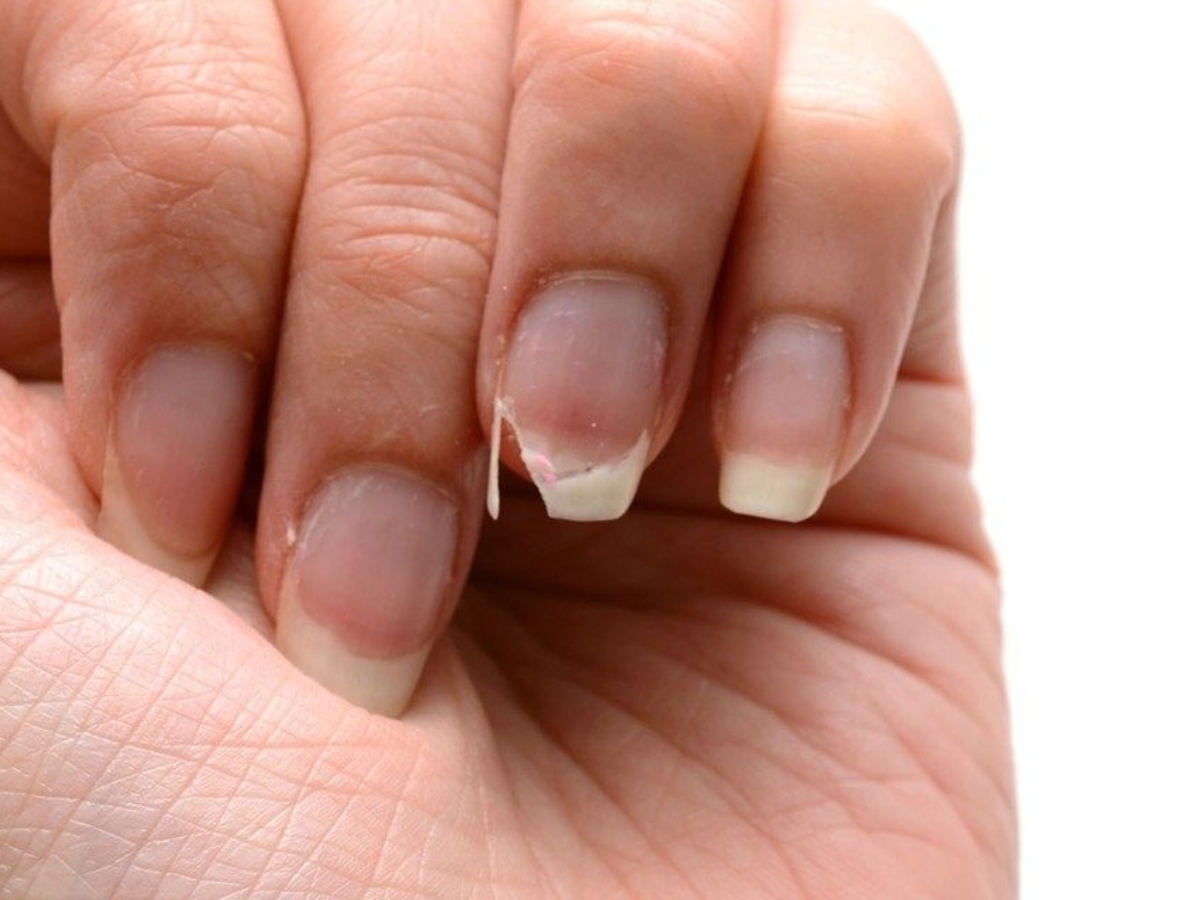Σπάνε τα νύχια σου στην άκρη; Τα 5 λάθη που τα αποδυναμώνουν χωρίς να το ξέρεις