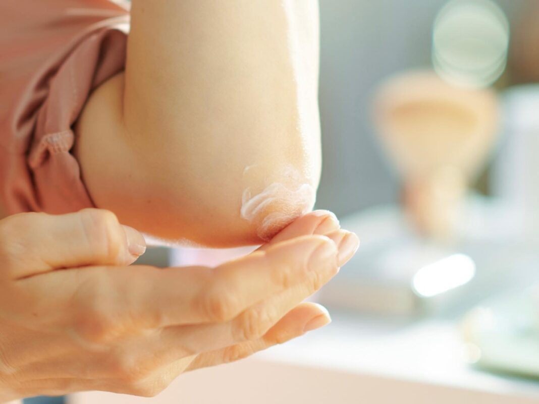 Ξηροί αγκώνες και γόνατα: 6 συνήθειες που μεταμορφώνουν την επιδερμίδα σε λίγες μέρες Ξηροί αγκώνες και γόνατα: 6 συνήθειες που μεταμορφώνουν την επιδερμίδα σε λίγες μέρες